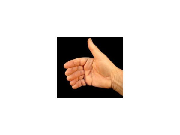 Sixth Finger Vernet (normal)