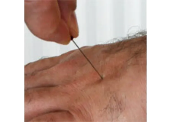 Pierced - Pin durch Hand by Steve Fearson