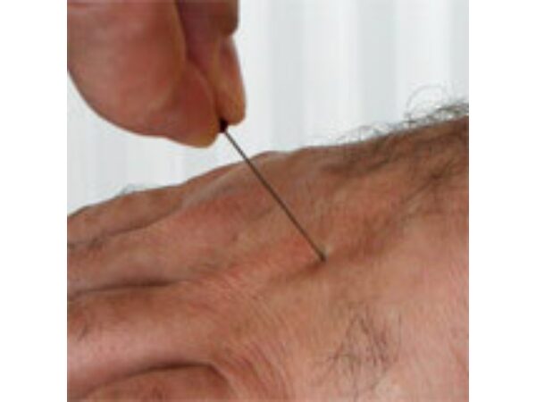 Pierced - Pin durch Hand by Steve Fearson